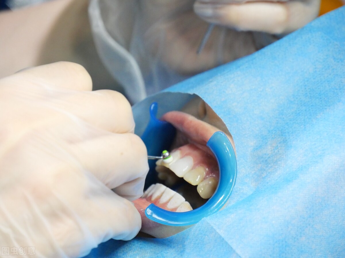 喝咖啡牙齿变黑吃什么能变白,抽烟喝咖啡怎么保护牙齿