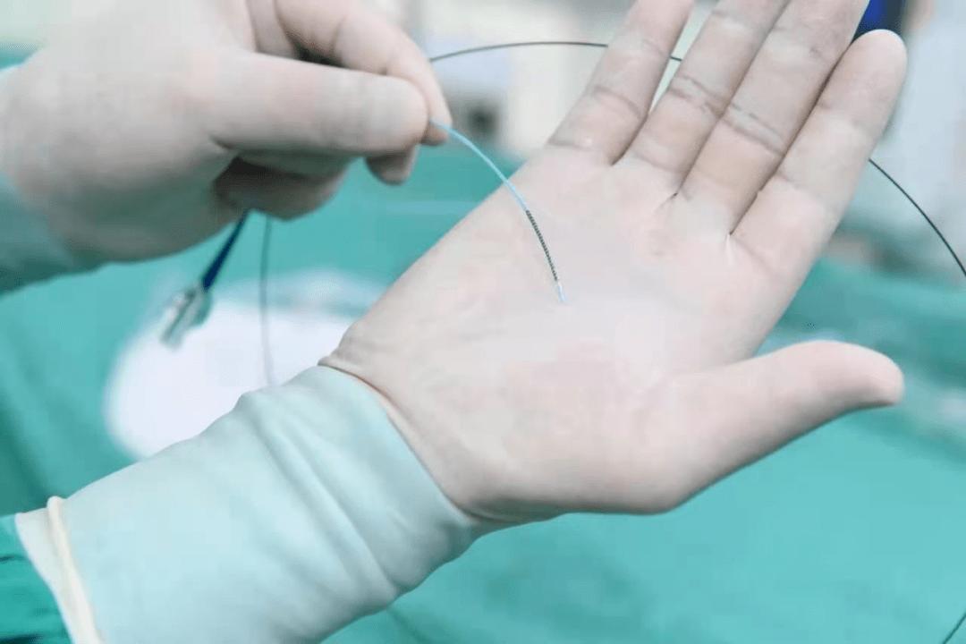 突发急性心梗做支架,急性心梗溶栓后还需要支架治疗吗