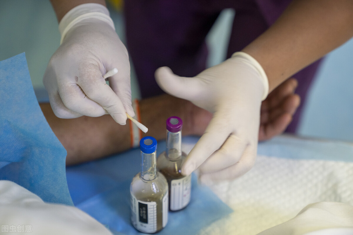 静脉采血如何防止针脱落,静脉采血晕血的原因及处理措施