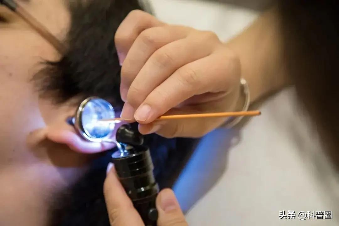 千万不要频繁掏耳朵,掏耳朵的后果有多严重