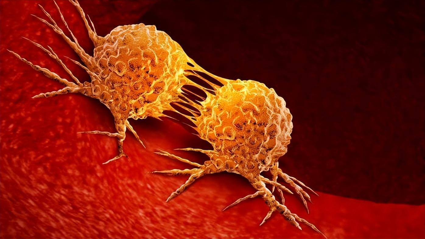 女的最近老是腰疼是宫颈癌吗,女生腿疼警惕癌症