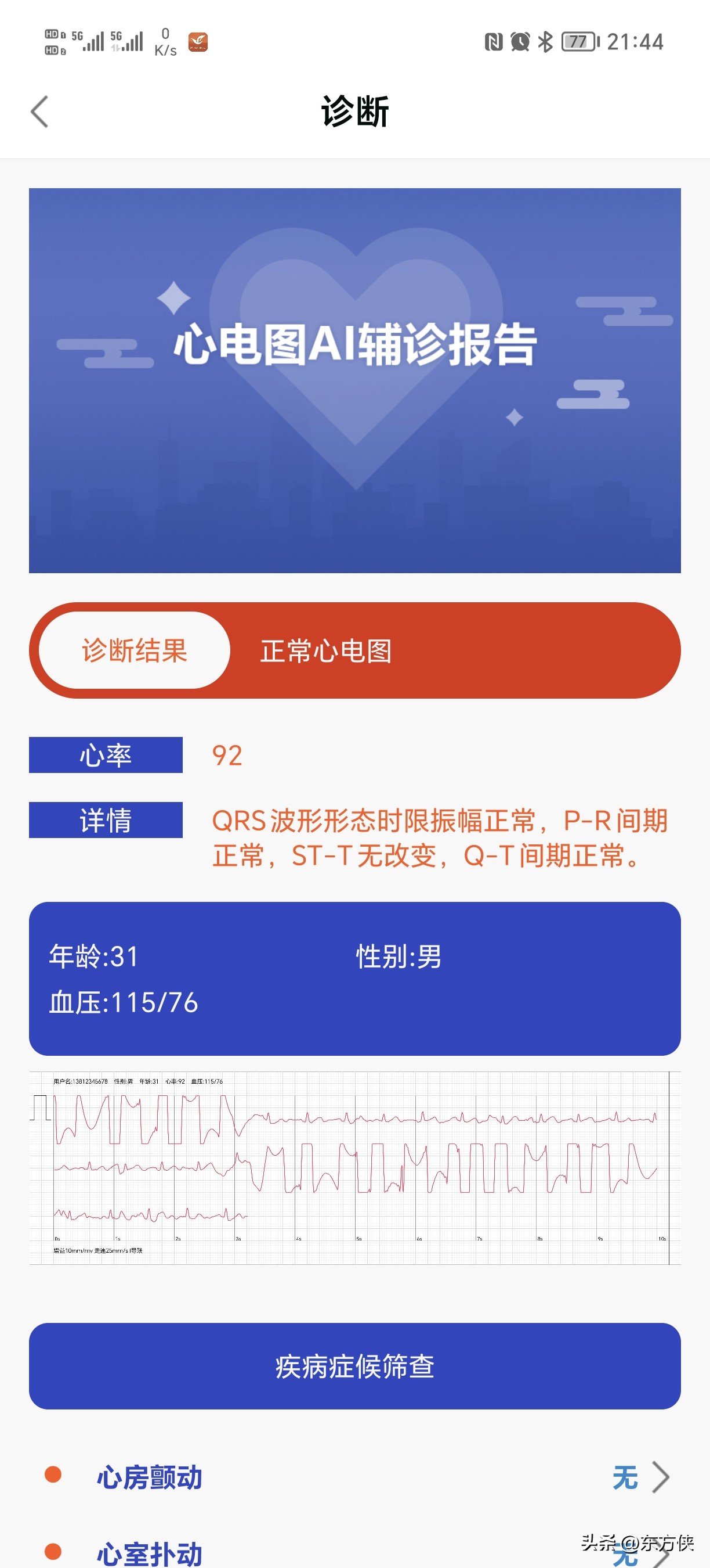 didoe55spro手表测血压准吗,didoe55spro顶配版智能手表