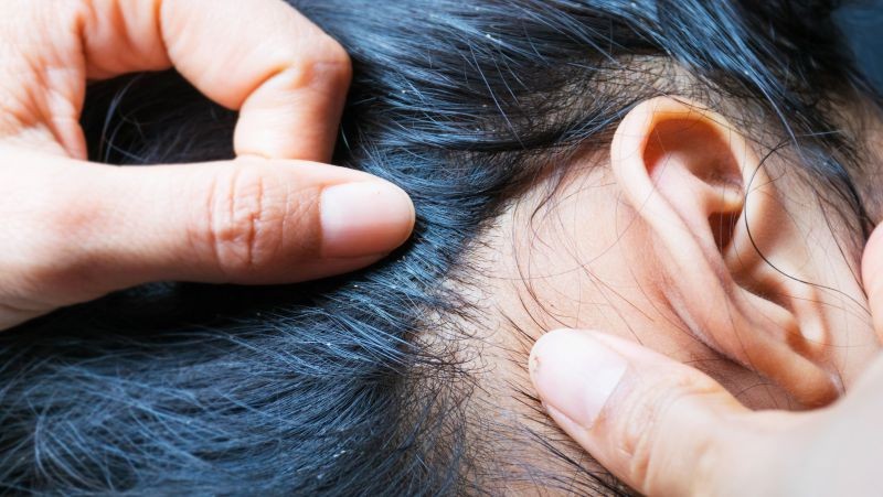 女子体内有蜱虫被医生拿镊子拔出,女子身上长虫医生拿镊子治疗