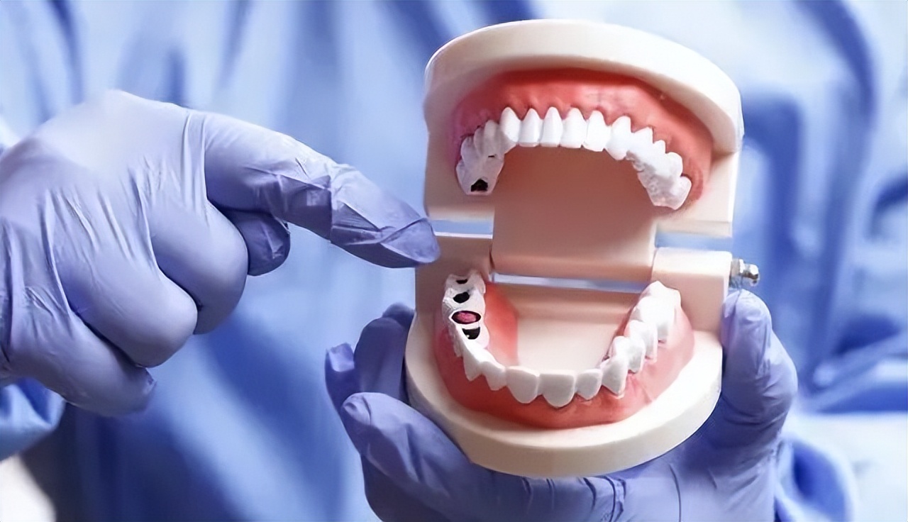 宁波种植牙医保试点医院,宁波公立医院种植牙集采