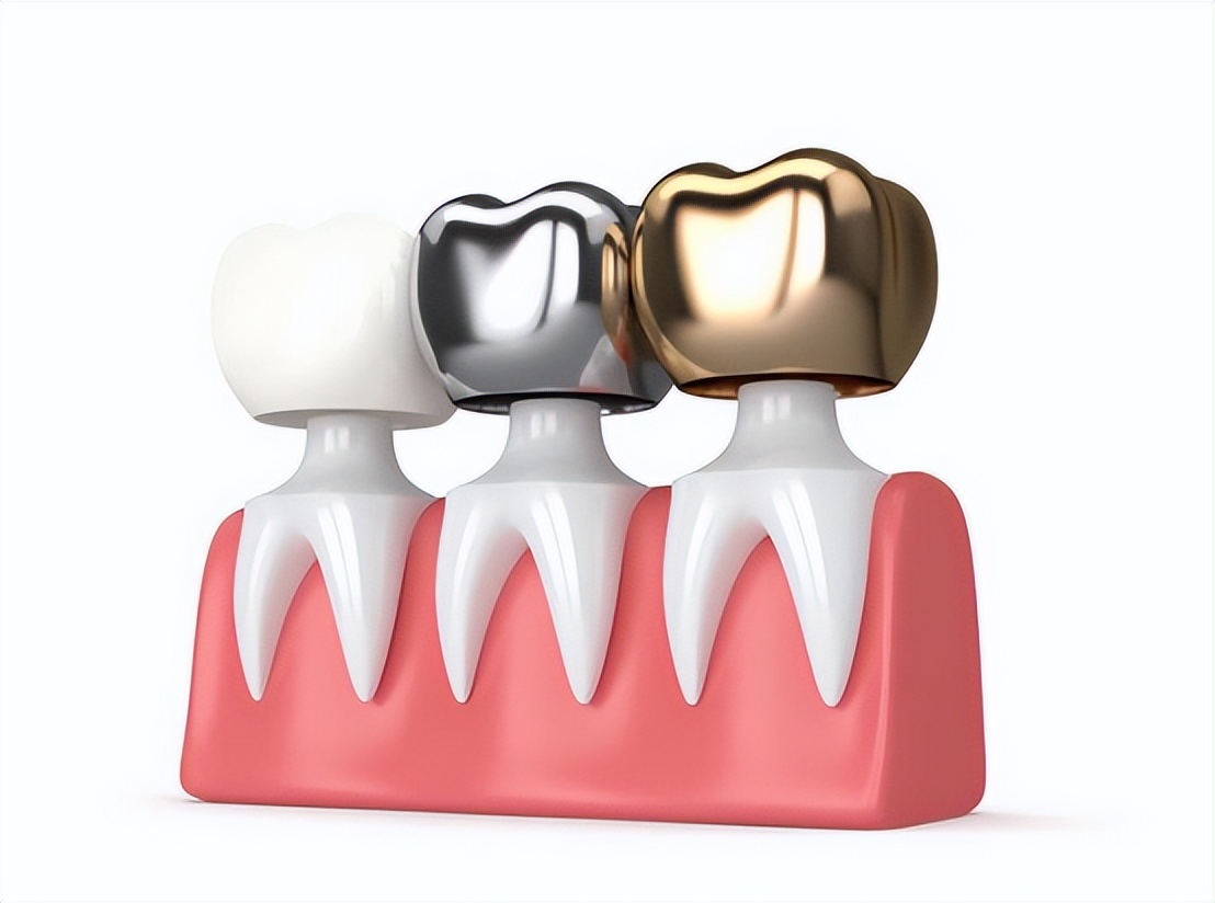 牙根纵裂怎么治疗最好,牙根病变的最好治疗方案