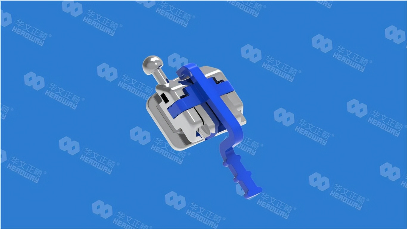 华文正畸自锁托槽价格,华文正畸是否是自锁托槽