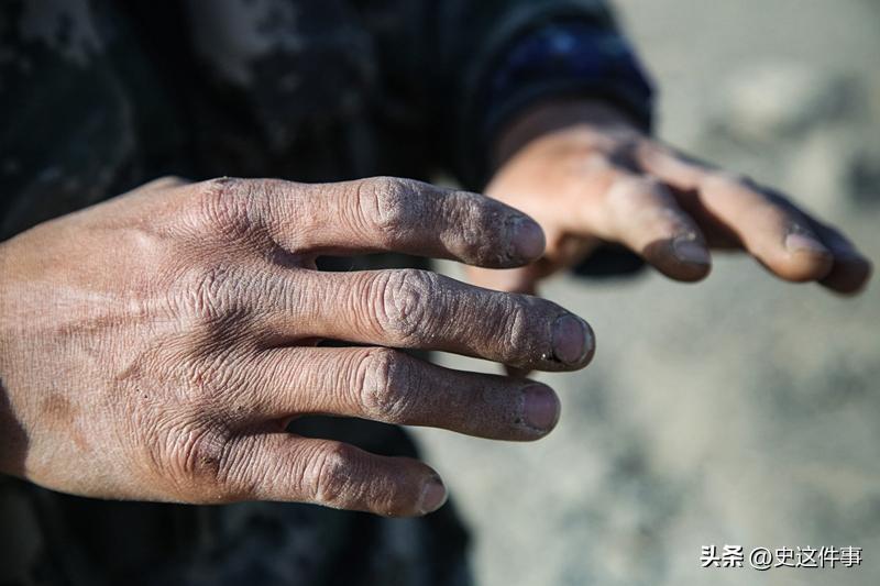 16岁女孩为养家三度卖血,16岁女孩为哥哥卖血上学山东