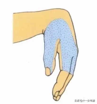 周围神经病和外周神经病,周围神经病