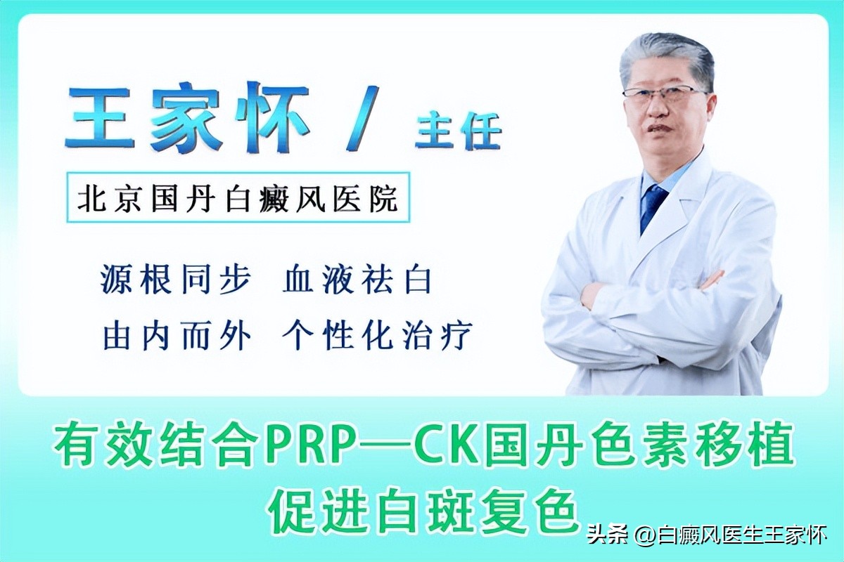 让白癜风快速变白,让白癜风快速发展