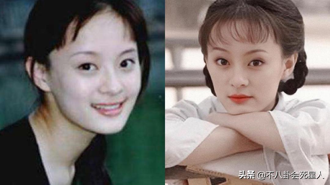 景甜悲伤蛙双眼皮照片,明星割双眼皮前后对比图