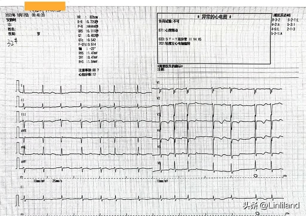 过速性房颤治疗,持续性房颤心动过速