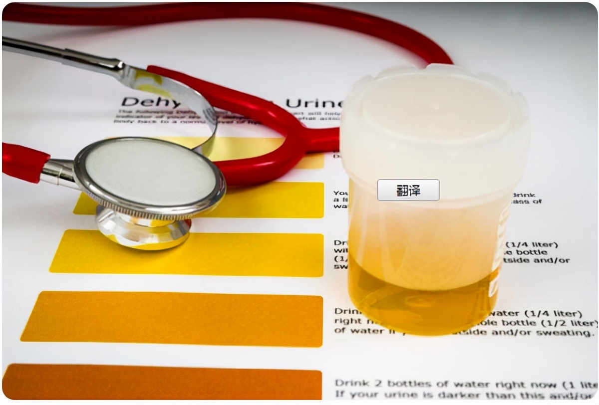 心衰引起肾衰中医最有效治疗,中医治肾衰的成功案例