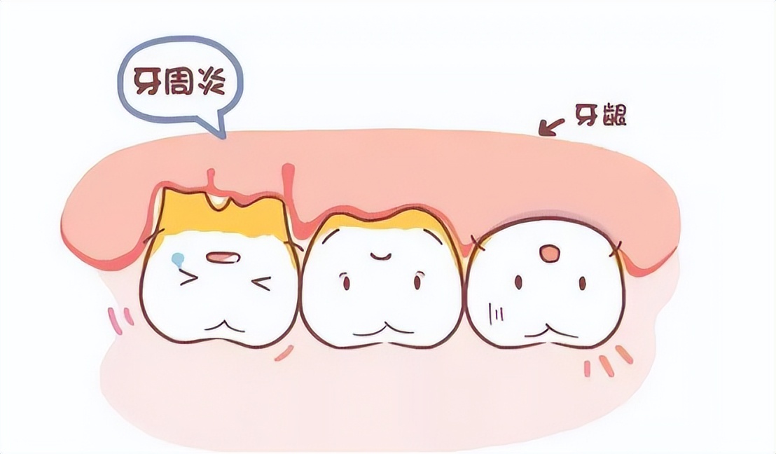 babysmile电动牙刷s202和s204,电动牙刷品牌真实测评