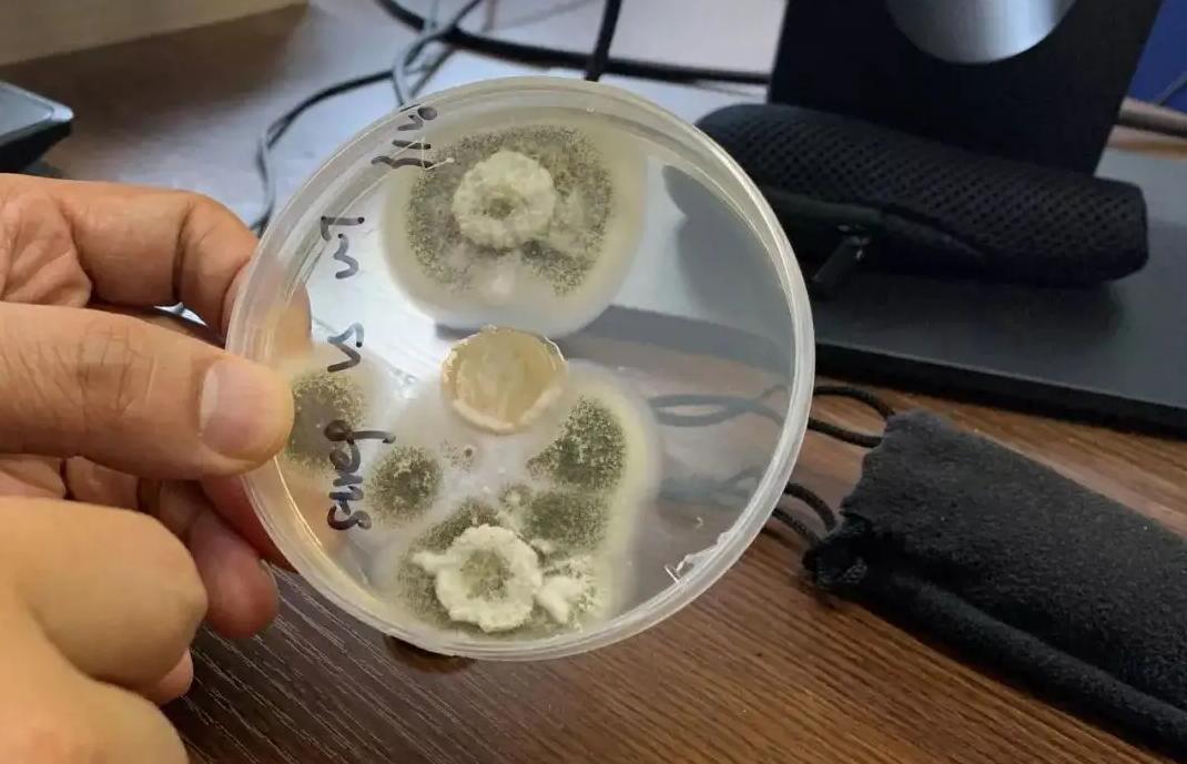 阿根廷传染病事件,澳大利亚发现最致命真菌