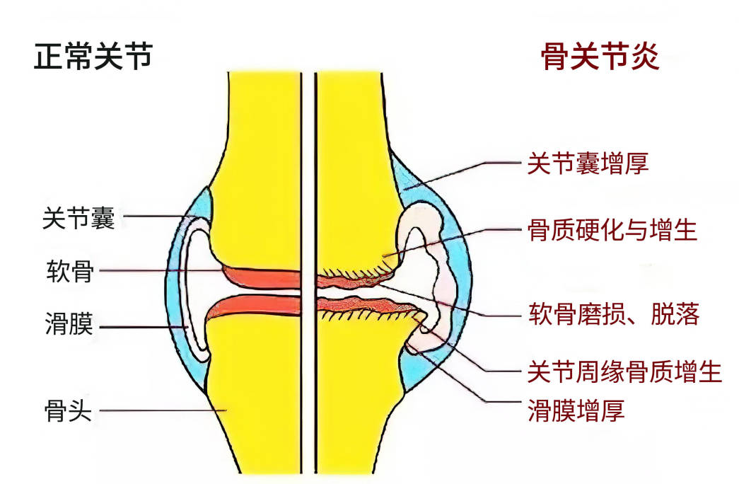 鞋子磨脚怎么办教你如何轻松解决,鞋子太紧磨脚