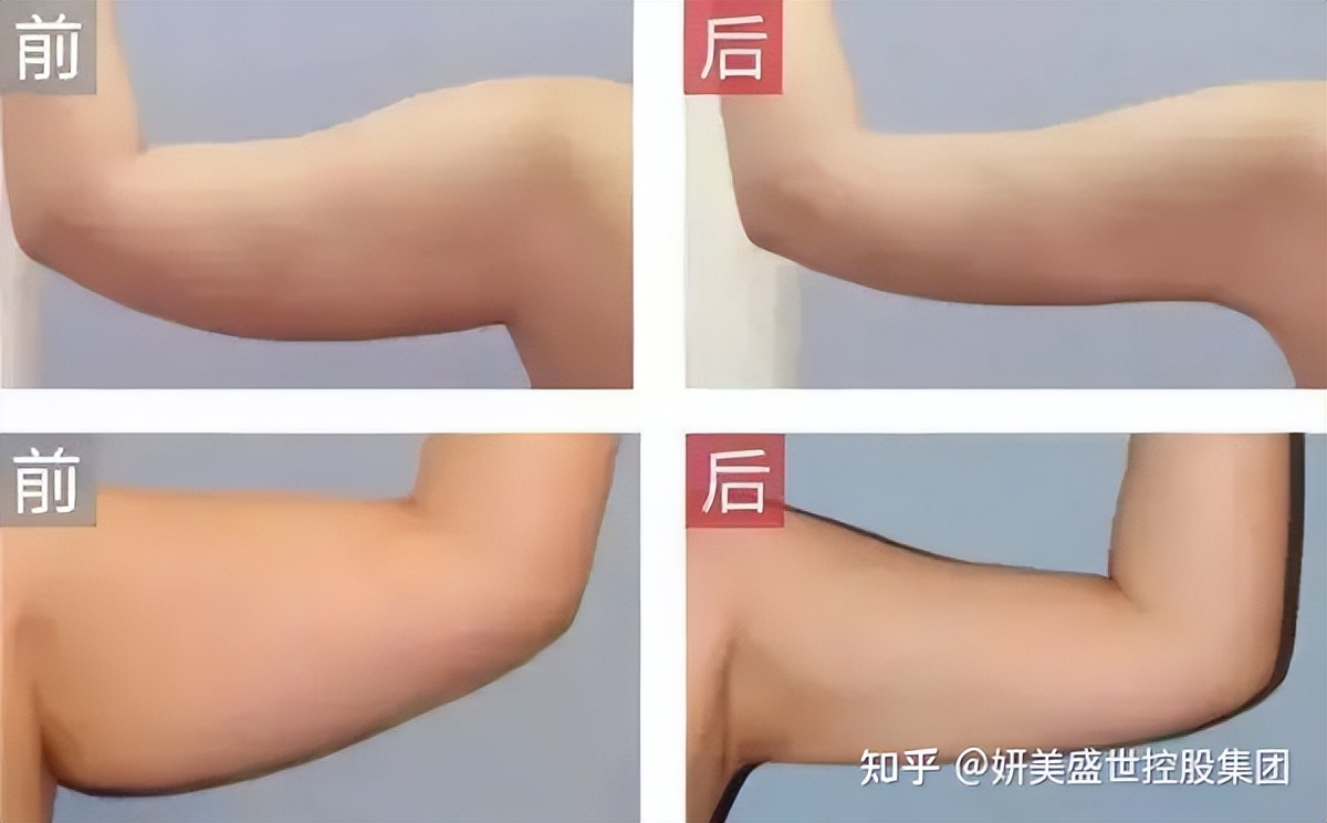 体雕衣与美体衣有区别吗,体雕衣女款