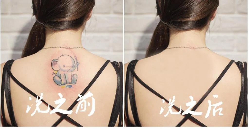 洗纹身真的不是一般人能承受的,洗纹身真的要下很大的决心