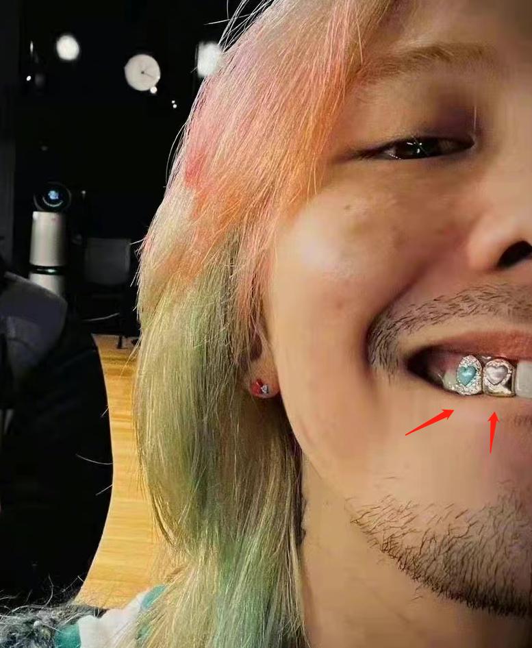 曾让杜海涛下跪的韩星又出辣眼造型！胡子拉碴，牙上还镶两颗彩钻