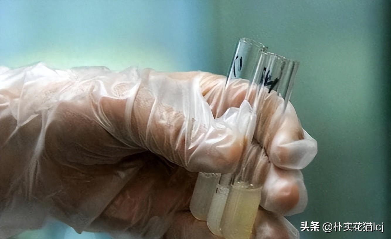 精子受孕未成功后去哪了,没有成功受孕的精子都去哪里了