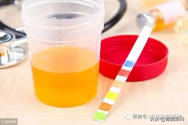 慢性肾脏病早期筛查及防治指南,儿童肾脏病的早期症状