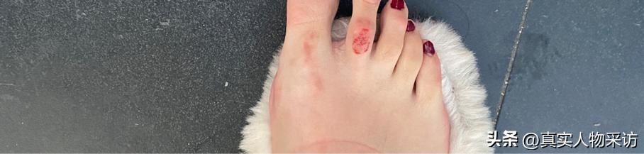 170厘米170斤模特,170体重150斤模特