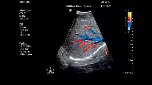 飞利浦philipscvr708,飞利浦philipsspt6627测评