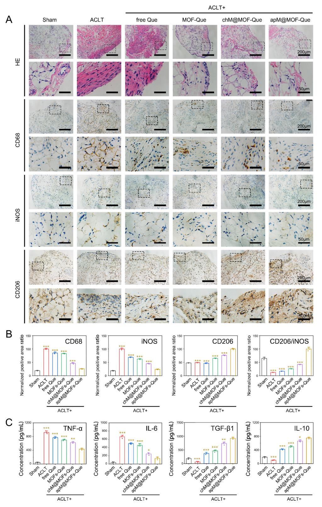 骨关节炎诊治要点及研究进展,骨性关节炎最新研究成果