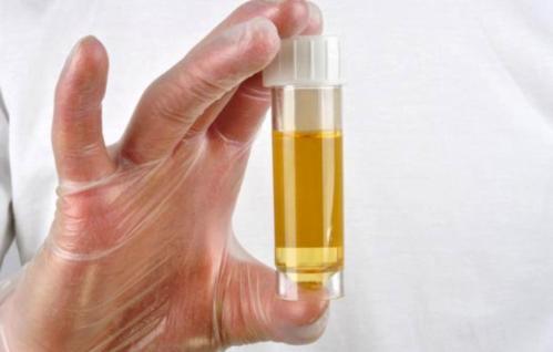 老是起夜吃啥药比较好,如何预防夜间频繁起夜的问题