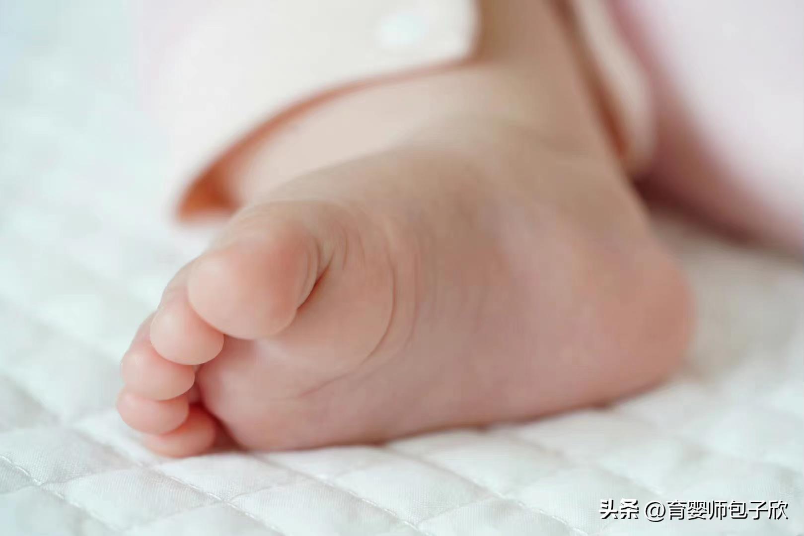 宝宝皮肤干燥泛红小妙招,宝宝秋季脸部泛红怎么办