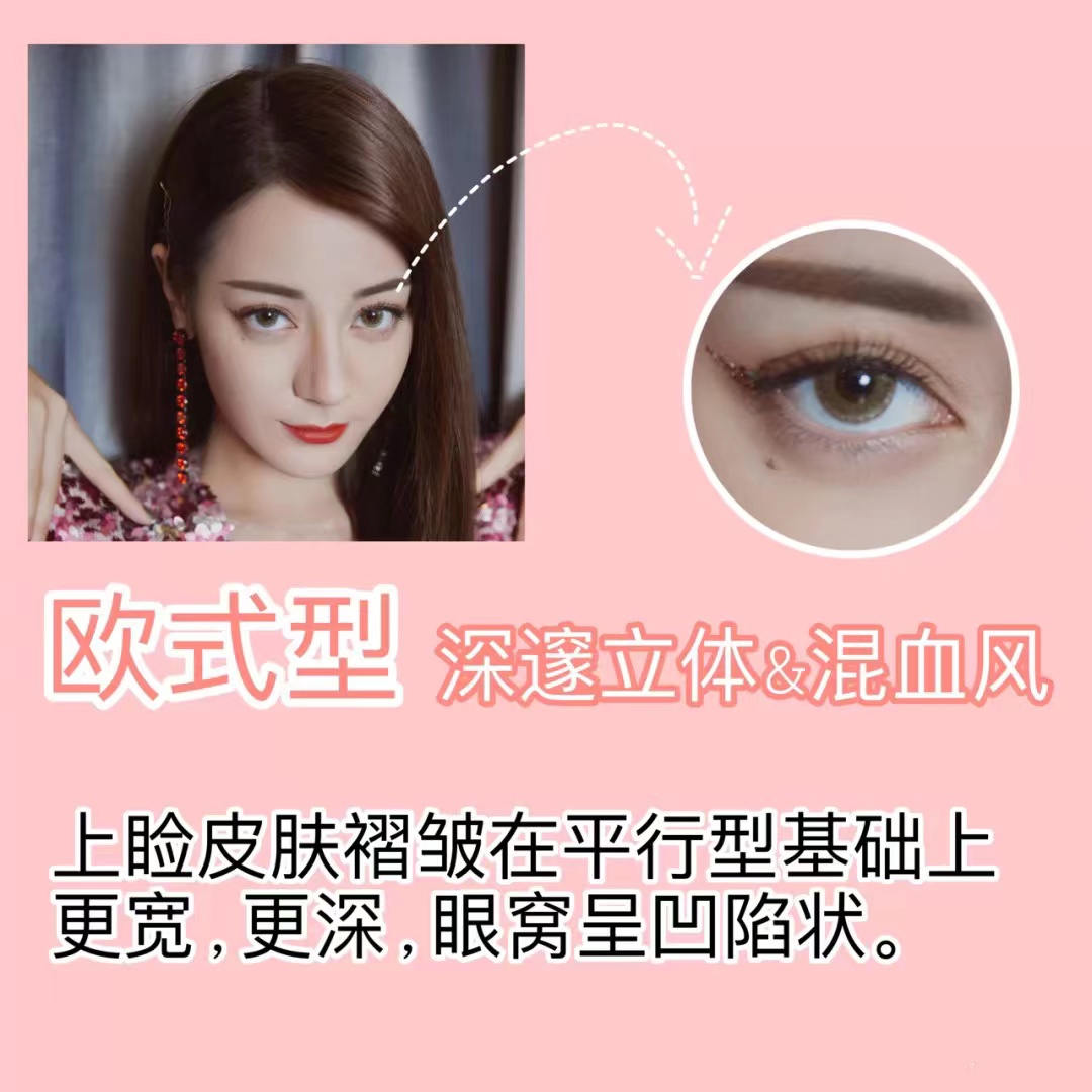 整形科普知识修复双眼皮,双眼皮整形有哪些常见方法