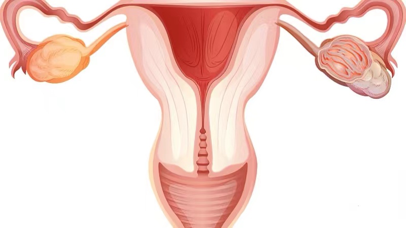 巨阴症是好事吗,巨阴症什么样