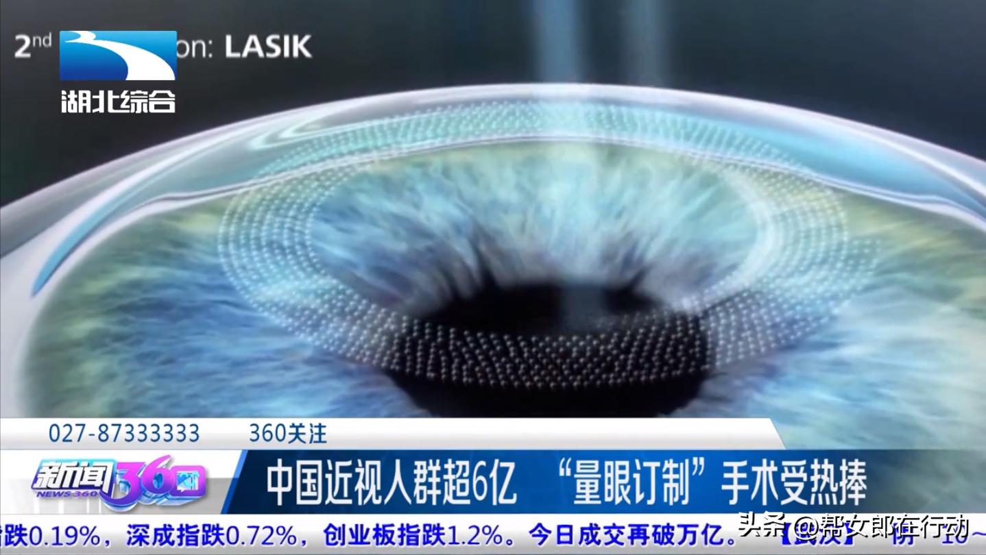 “量眼订制”手术受热捧，眼部激光手术质量逐年上升，安全性有保障