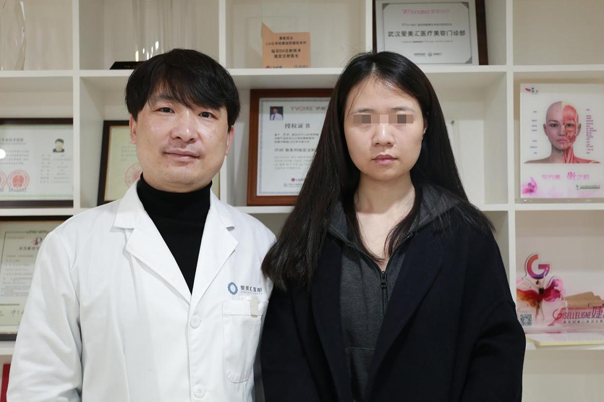 30岁女人做脸部美容,脸部面吸手术后的真实感受