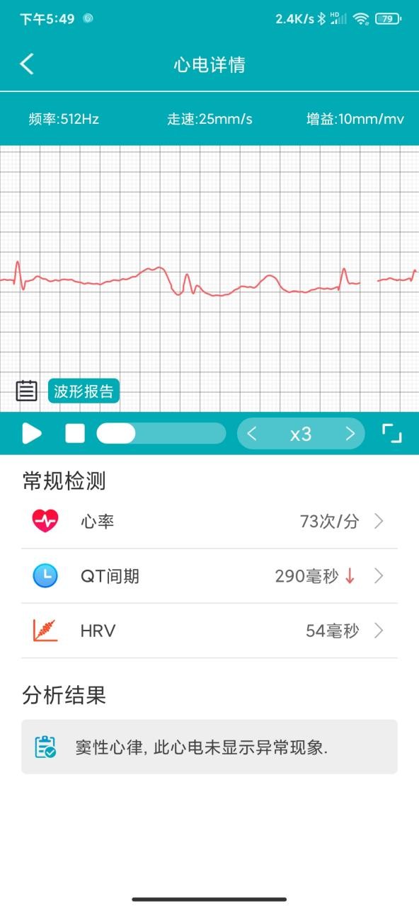 didof50s血糖手环,didoy2s智能血压手环测评