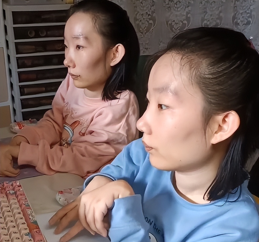 母亲捐渐冻症儿子眼角膜,18岁渐冻症男孩离世捐献角膜一切