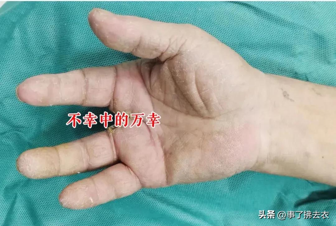 一条鱼引发的惨剧,一条鱼引发的悲剧8死13伤