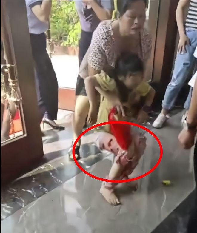 小女孩被恶犬咬原视频,被恶犬咬伤7岁女童状态平稳