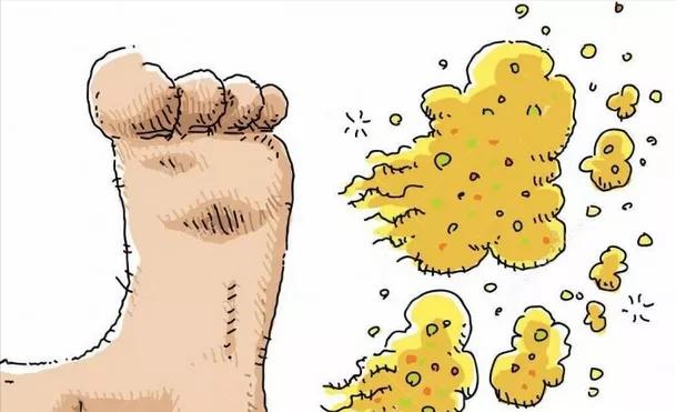 脚气痛痒难耐一个小妙招轻松解决,脚气痒得很怎么解决