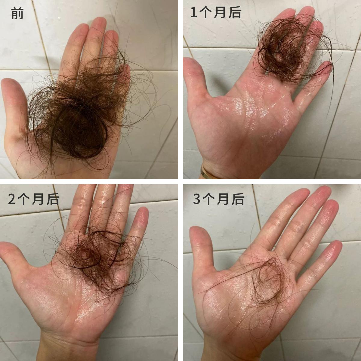 防脱发洗发水排名第一真实测评,洗发水推荐2022公认最好的洗发水