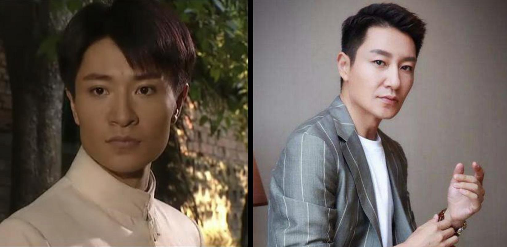 老演员整容脸变形,老年人整容前后照片