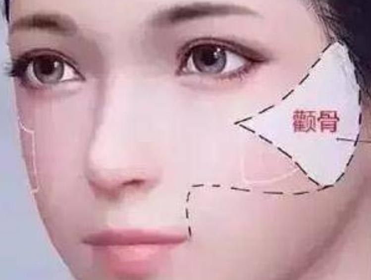 女人颧骨高杀夫不用刀真的吗,女人颧骨高杀夫不用刀上句是什么