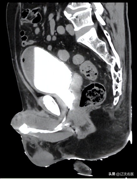 数字化助力优质医疗资源下沉,数字化医疗助力服务质量