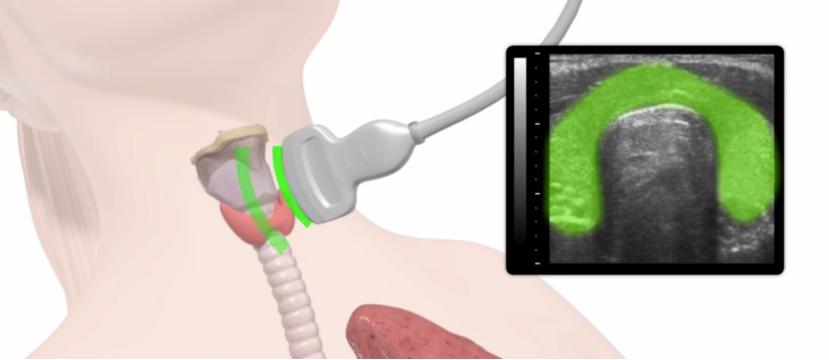 超声检查注意事项动画,超声检查注意事项