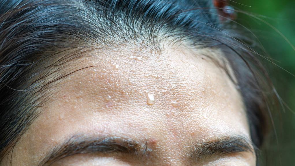 湿疹痱子如何辨别,湿疹和痱子怎么能分清楚