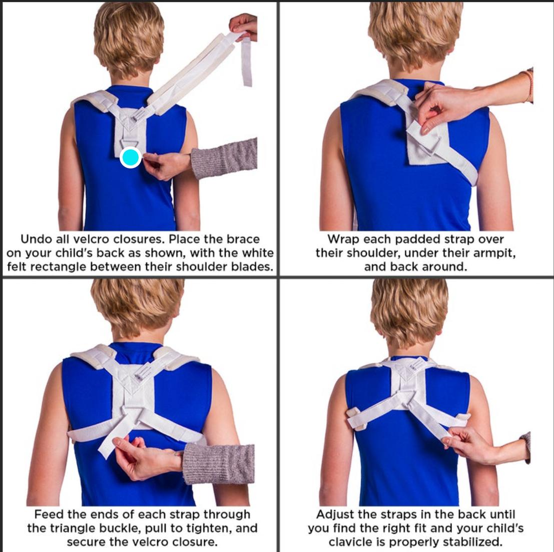 锁骨骨折吃什么食物最好,锁骨骨折怎么绑绷带视频