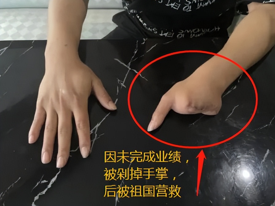 缅北诈骗人冒充被拐的人回国,深入了解缅北骗局