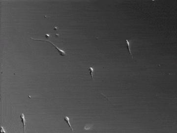 精子形成原理,精子怎么形成的过程动画