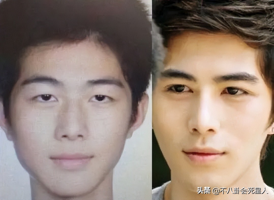 景甜双眼皮调整前后,明星自曝医美