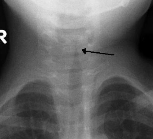 给脑壳钻孔、用吸血虫治病，这些古代治疗手段吓到我了