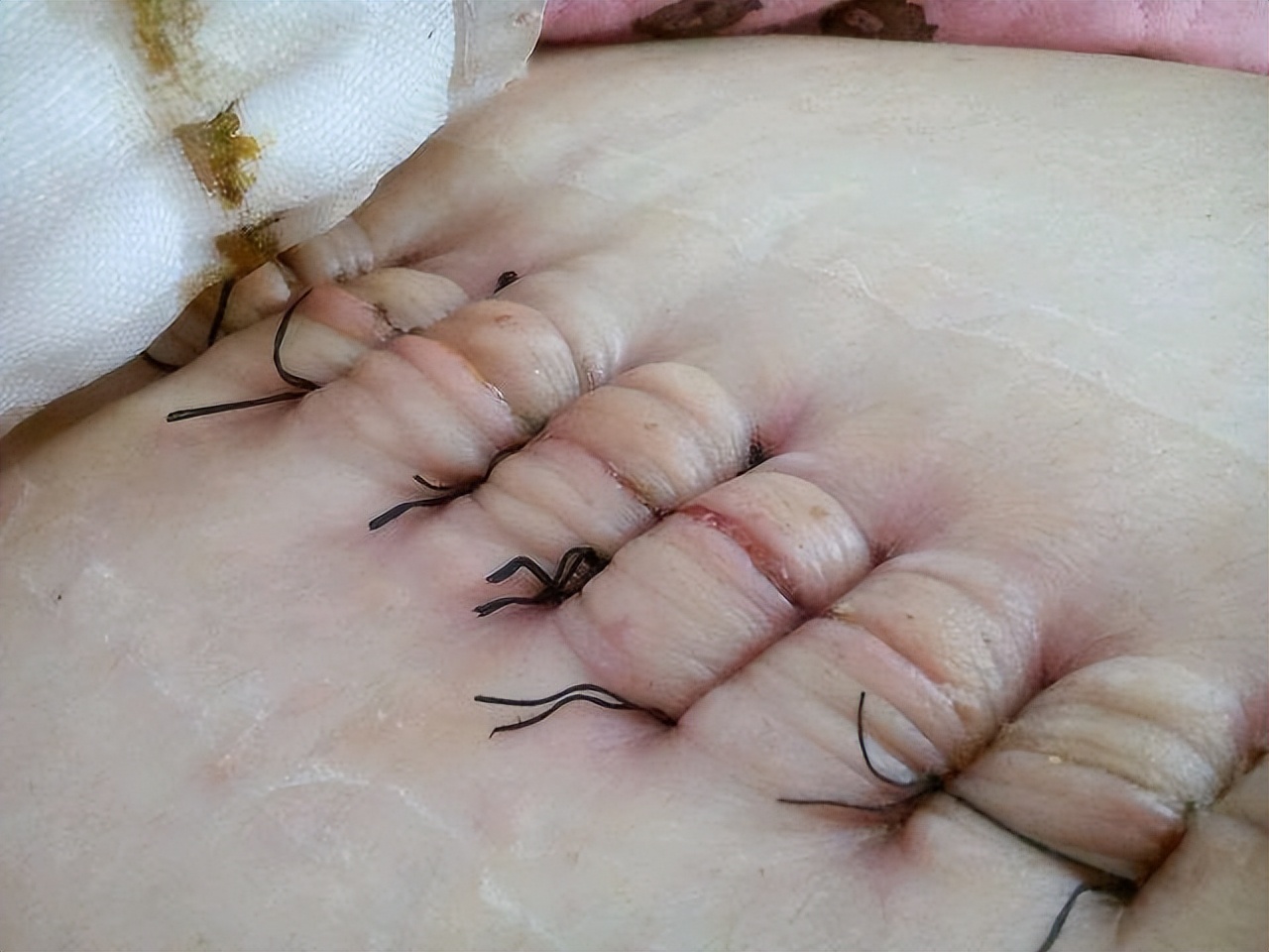 妇产科规培病例讨论记录,妇产科规培三年个人计划